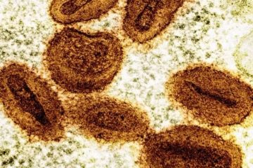 Pós Carnaval: Brasil tem 47 casos confirmados de Mpox em cinco estados
