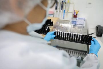 Fiocruz produzirá remédio de alto custo contra esclerose múltipla